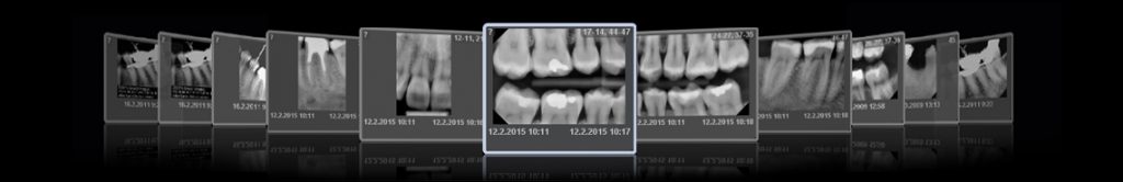 2D Imaging Ala Full Hd