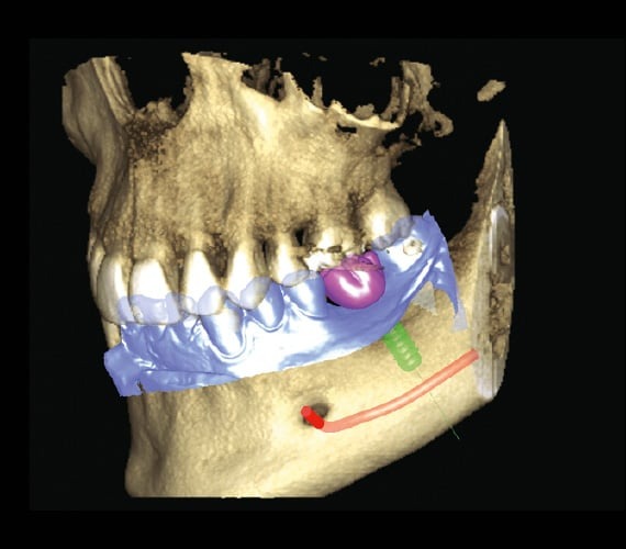 3D Promax Planmeca 3D Promax Planmeca