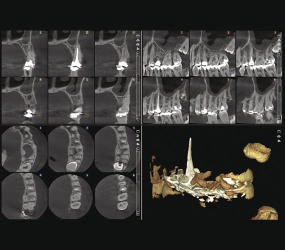 Cbct Diş Görüntüleme Sistemleri Cbct Diş Görüntüleme Sistemleri