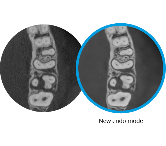 New Endo Mode Website