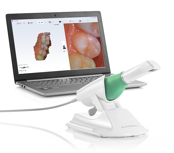 Planmeca Emerald Dental Scanner Digital Accuracy Planmeca Emerald Dental Scanner Digital Accuracy