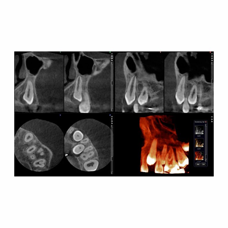 Planmeca-Promax-3D-Classic-Görüntüleme-Cbct-1 Planmeca-Promax-3D-Classic-Görüntüleme-Cbct-1