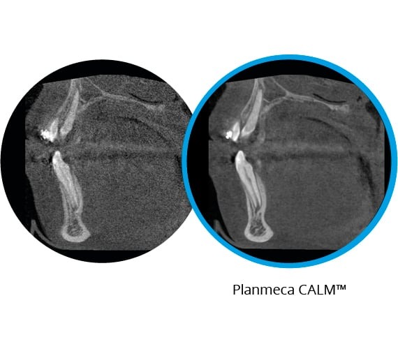 planmeca promax calm