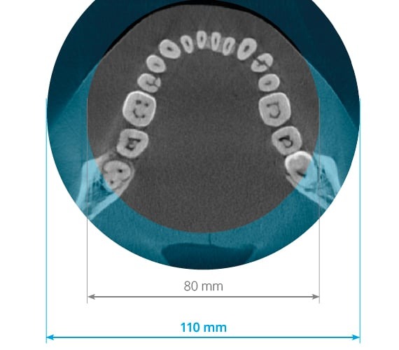 Planmeca Promax Cbct Görüntüleme Cihazı Planmeca Promax Cbct Görüntüleme Cihazı
