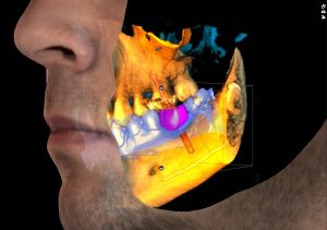 planmeca promax cbct görüntüler