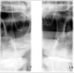Planmeca Proone Lateral Pa Tmj 300×148