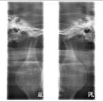 Planmeca Proone Lateral Tmj 300×149