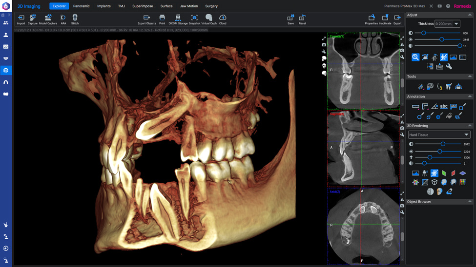 Planmeca Romexis 3D Module Planmeca Romexis 3D Module