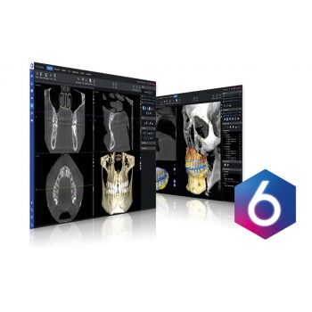 planmeca-romexis-all-in-one-dental-yazılım