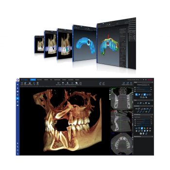 Romexis-3D-Goruntuleme-Diş-Yazılımı