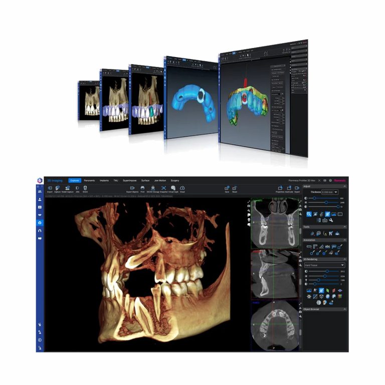 Romexis-3D-Goruntuleme-Diş-Yazılımı Romexis-3D-Goruntuleme-Diş-Yazılımı