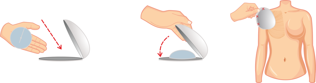 Braxon Fast Dermal Aseluler Matriks Braxon Fast Dermal Aseluler Matriks