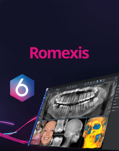 romexis dental diş yazılımı