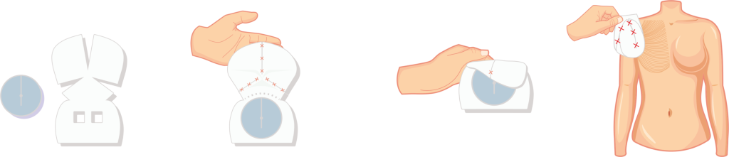 Braxon Dermal Aseluler Matriks